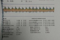 胎儿脐血流监测（胎儿脐血流监测是做什么检查）