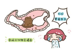 孕期白带多发黄（孕期分泌物多发黄正常吗）