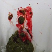 孕期大便出血怎么回事（怀孕早期的孕妇便秘拉出血了该怎么办？为什么会拉出血呢）