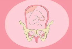 有助于胎儿入盆的姿势（35周胎宝宝在肚子里的姿势）