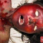孕妇死亡胎儿会死吗（孕妇死亡胎儿会死吗视频）