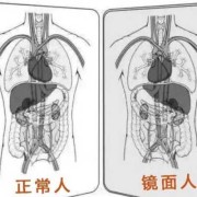 镜子宝宝是什么意思,胎儿镜面人是什么意思