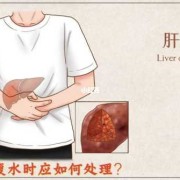 孕期有腹水（孕期有腹水怎么办）