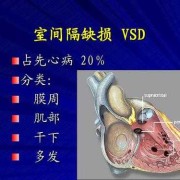 室间隔缺损的胎儿多吗（小儿室间隔缺损崤下型能自愈吗）