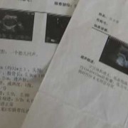 孕期b超时间表（孕期b超时间表）