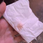 孕期白带白色（怀孕有淡粉色白带怎么回事）