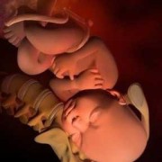 38周胎儿入盆图片（38周胎儿入盆图片）
