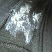 为啥怀孕之后，阴部有股臭臭的很难闻的味道,