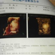 怀孕胎儿偏小2周（b超显示孕周比实际小是什么原因）