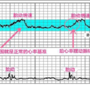 孕38周胎心164好不好?怎么通过胎心来判断宝宝的发育情况,胎儿38周发育标准尺寸