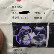 怀孕18周做什么检查,18周胎儿彩超图片