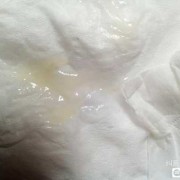 孕期私处湿（内衣里面每天湿湿的怎么办）