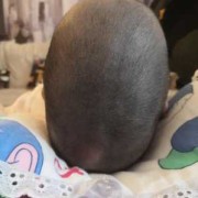 宝宝头骨发育过程,胎儿颅骨骨缝闭合