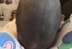 宝宝头骨发育过程,胎儿颅骨骨缝闭合