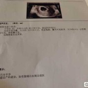 怀孕期间反应小（怀孕一个多月了，为什么一点反应都没有）