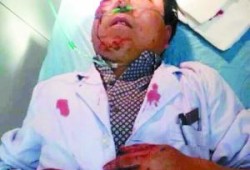 做B超时胎儿骶尾骨显示不清,胎儿部分结构显示不清是什么意思