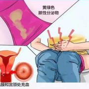 有滴虫严重吗滴虫是什么会有什么影响啊,孕妇滴虫会传染胎儿吗图片