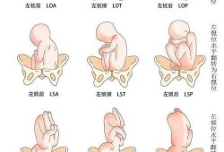 胎儿枕位是什么意思（左枕前位和左枕后位有什么区别）