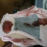 怀孕期间出血肚子不疼（怀孕期间出血肚子不疼是什么情况）