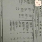 孕妇尿检上皮细胞高是怎么回事,