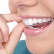孕期矫正牙齿（孕期矫正牙齿有影响吗）