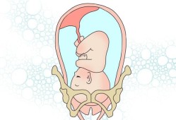 孕38周胎儿还没入盆（怀孕38周胎儿已入盆怎么样才能提前生产）