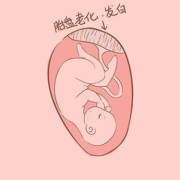 胎盘老化对胎儿有什么影响（孕晚期胎盘老化对胎儿有什么影响）