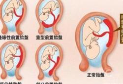 胎儿位于子宫后壁（胎儿位于子宫后壁是什么意思）