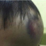 两个多月的宝宝头撞门上了会不会有影响,小孩头小会影响大脑发育吗