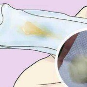 孕期流黄色分泌物（孕期流黄色分泌物怎么回事）