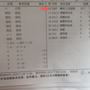 尿常规检查鳞状上皮细胞高是什么原因,怀孕鳞状上皮偏高是什么原因
