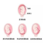 胎盘对胎儿的作用（胎盘从什么时候开始长？孕几周开始长胎盘呢）
