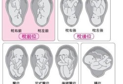 胎儿右枕前位是什么意思（胎儿右枕前位图片示意图）