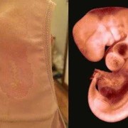 孕妇羊水脏影响胎儿是什么,羊水没了胎儿会怎么样呢
