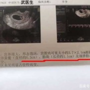 胎儿多大有胎心（一般怀孕多久才有胎心）