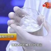 为什么怀孕以后会有白色的东西,孕期白色分泌物像浆糊