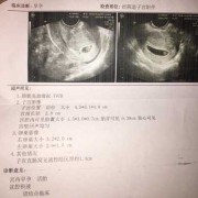经常做彩超对胎儿有影响吗（做彩超对胎儿影响大吗？有没有影响呢）