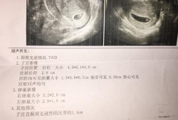 经常做彩超对胎儿有影响吗（做彩超对胎儿影响大吗？有没有影响呢）