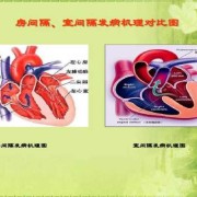胎儿房缺（胎儿房缺室缺能留下来吗）
