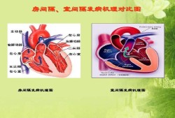 胎儿房缺（胎儿房缺室缺能留下来吗）
