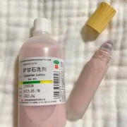 孕期头皮屑特别多怎么办（孕期头皮屑特别多怎么办可以用炉甘石洗剂吗）