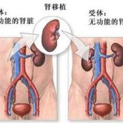 胎儿双肾集合部分离（怀孕七个月胎儿双肾集合系统分离是什么原因）