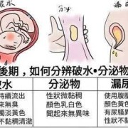 孕期分泌物多怎么办（孕晚期分泌物增多怎么回事）
