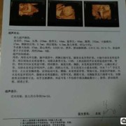 孕24周的四维彩超各项正常值是多少,孕24周胎儿生长指标对照表