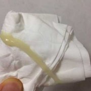 孕期还会有白带吗