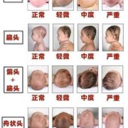 胎儿几个月定肤色（胎儿几个月定肤色如何让胎儿皮肤变白）