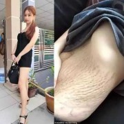 妊娠纹是什么？妊娠纹怎么消除,孕期泳装身材变化记录视频