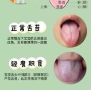 孕妇舌苔发白怎么办？是什么原因,孕期舌苔白厚口苦口臭怎么调理