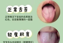 孕妇舌苔发白怎么办？是什么原因,孕期舌苔白厚口苦口臭怎么调理