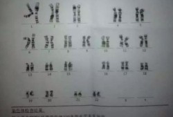 胎儿形状（大家来看看孕囊男女啦～孕45天，同时做了B超和阴超，孕囊形状都好圆好圆，不过B超的孕囊数据是32*28*15，阴超的孕囊数据是29*24*20，这到底是男宝还是女宝呀～）